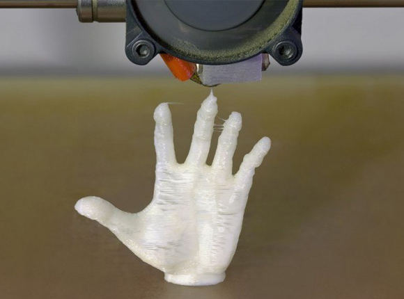 Get High-Quality 3D Printed Prosthetic Hands